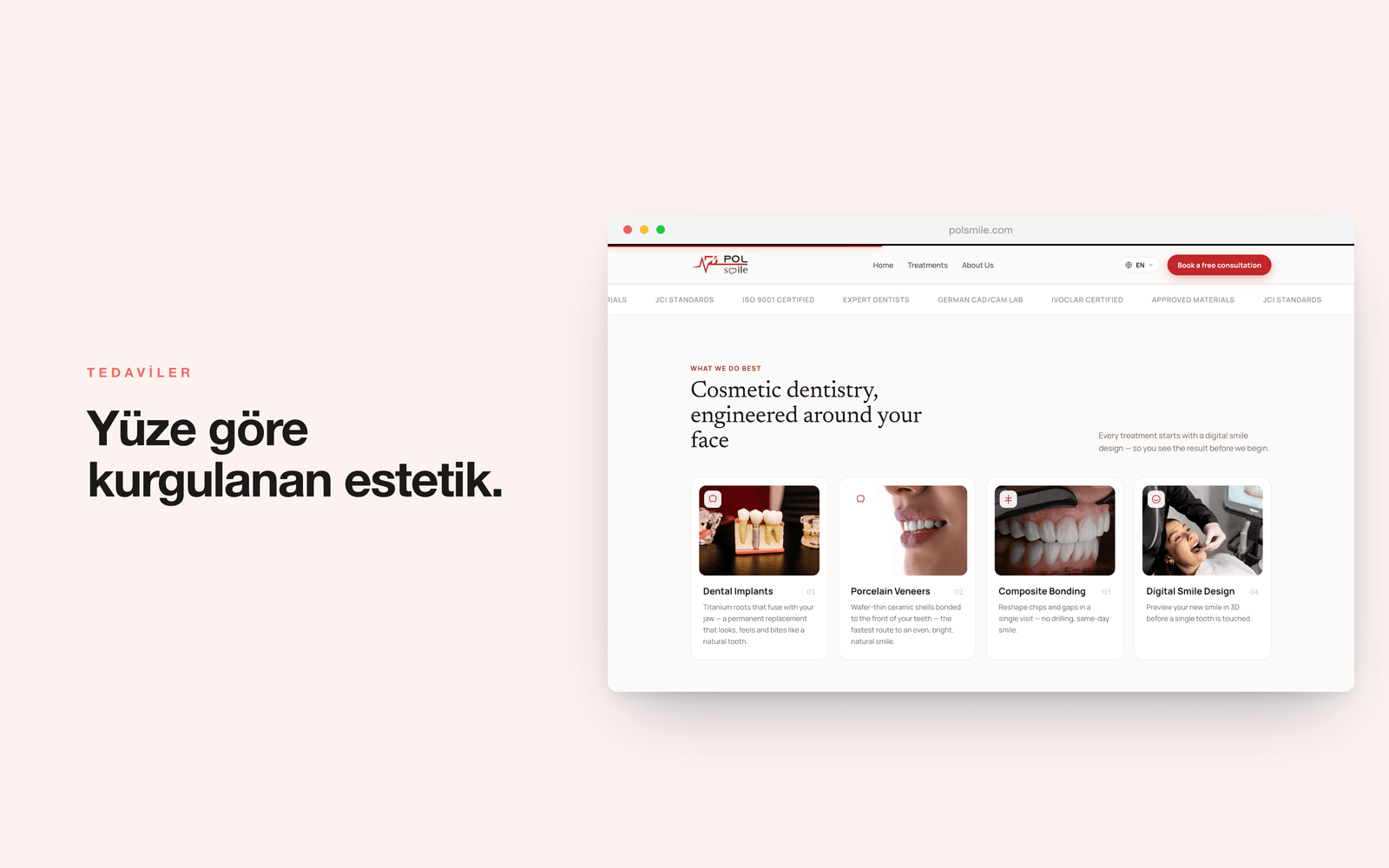 POLSMILE — implant, veneer, bonding ve dijital gülüş tasarımı kartları