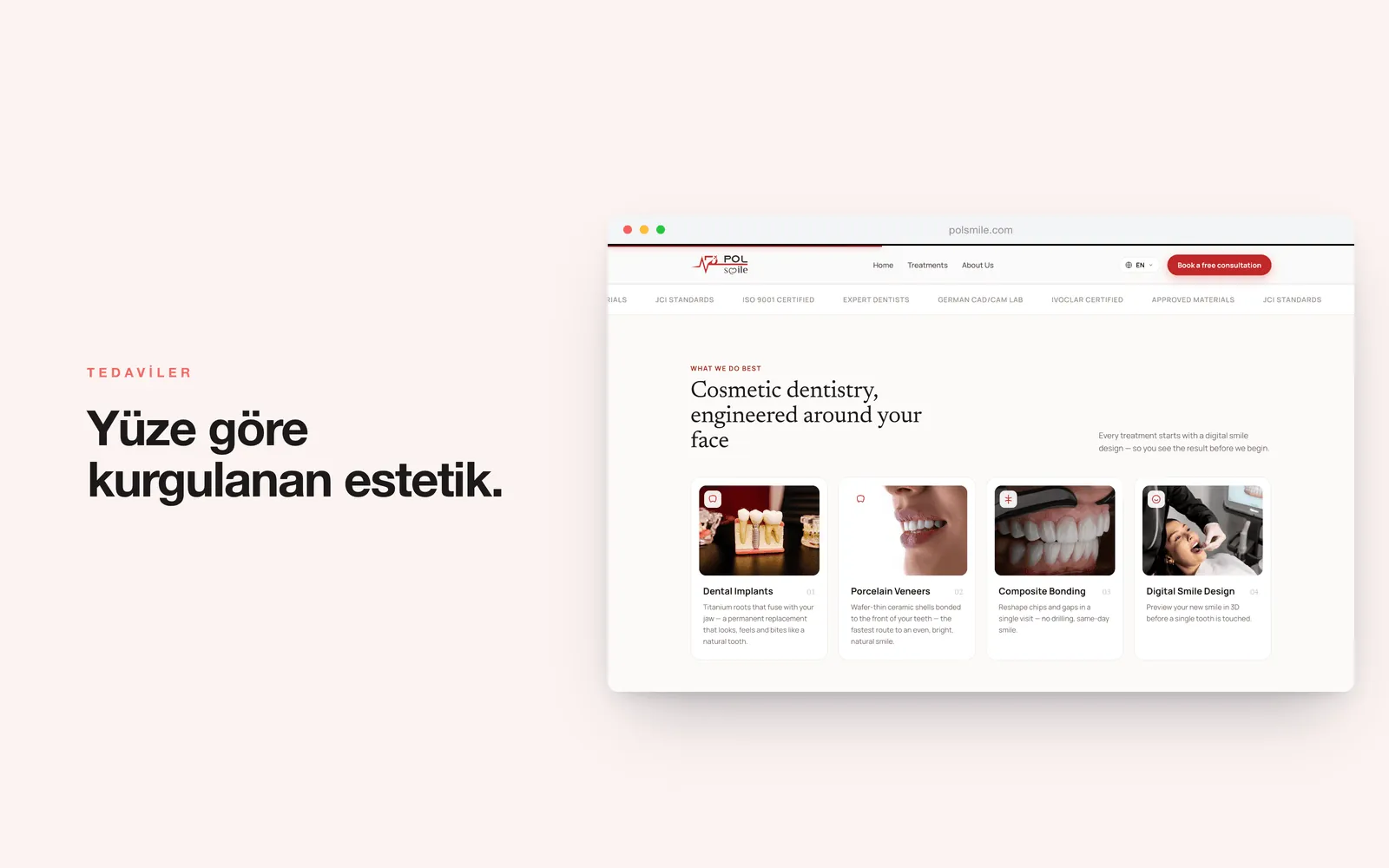 POLSMILE — implant, veneer, bonding ve dijital gülüş tasarımı kartları