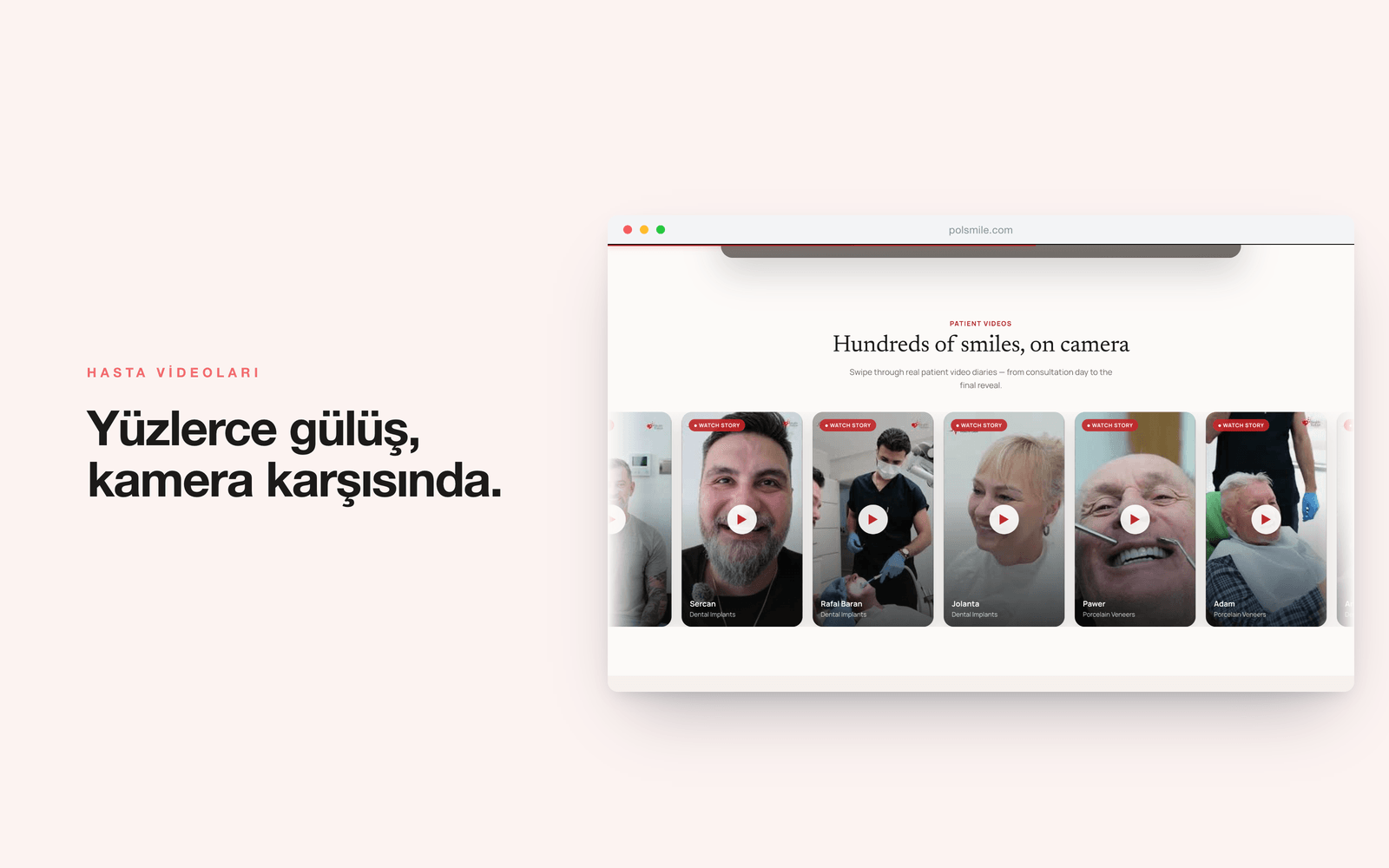 POLSMILE — hasta video günlükleri bölümü