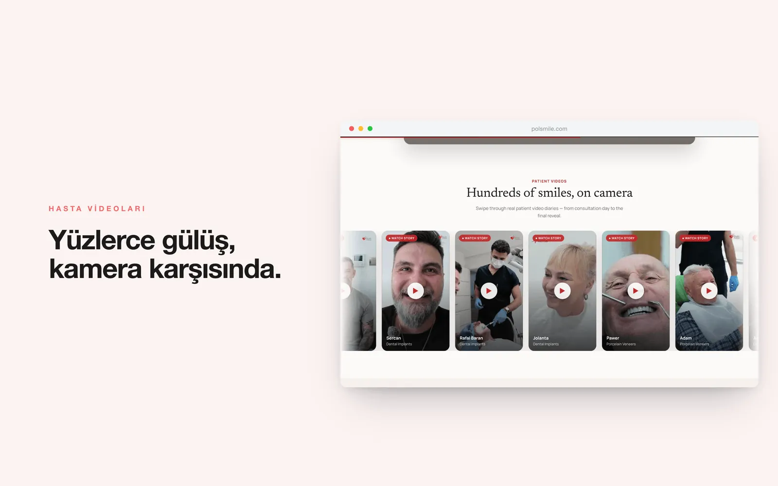 POLSMILE — hasta video günlükleri bölümü