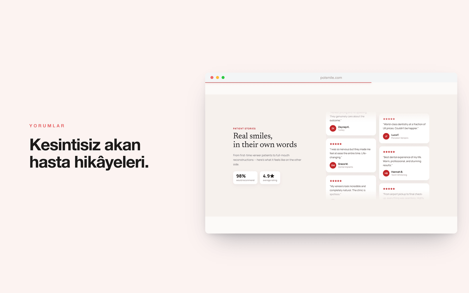 POLSMILE — kesintisiz akan hasta yorumu sütunları ve istatistikler