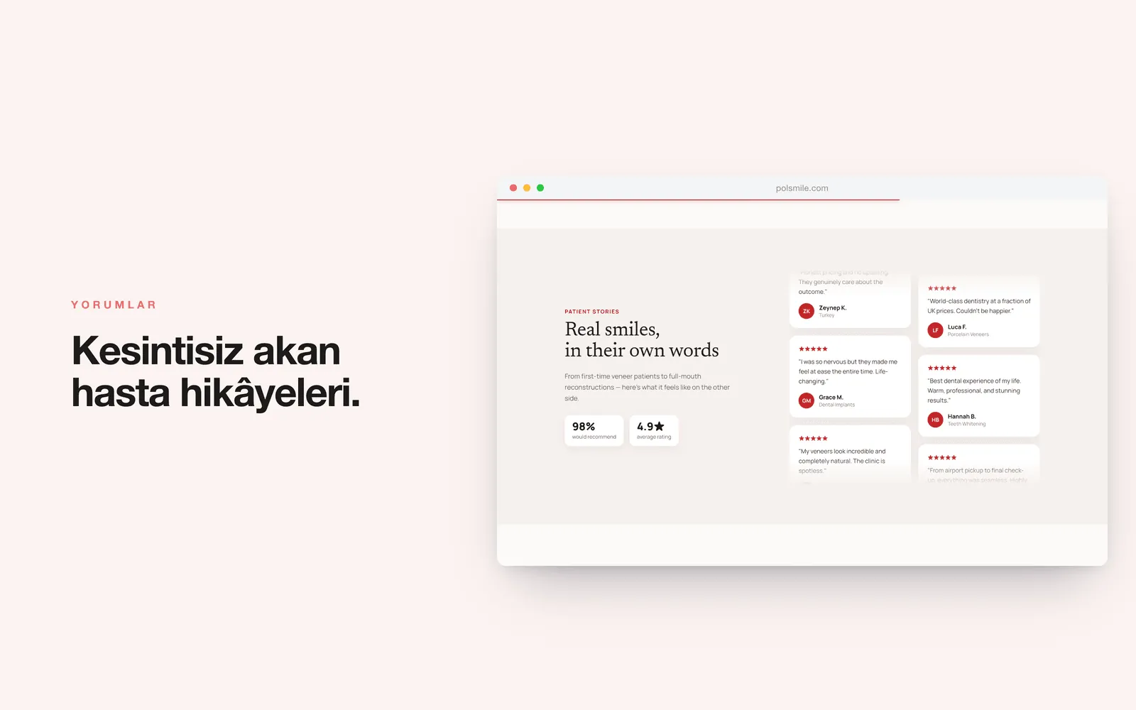 POLSMILE — kesintisiz akan hasta yorumu sütunları ve istatistikler