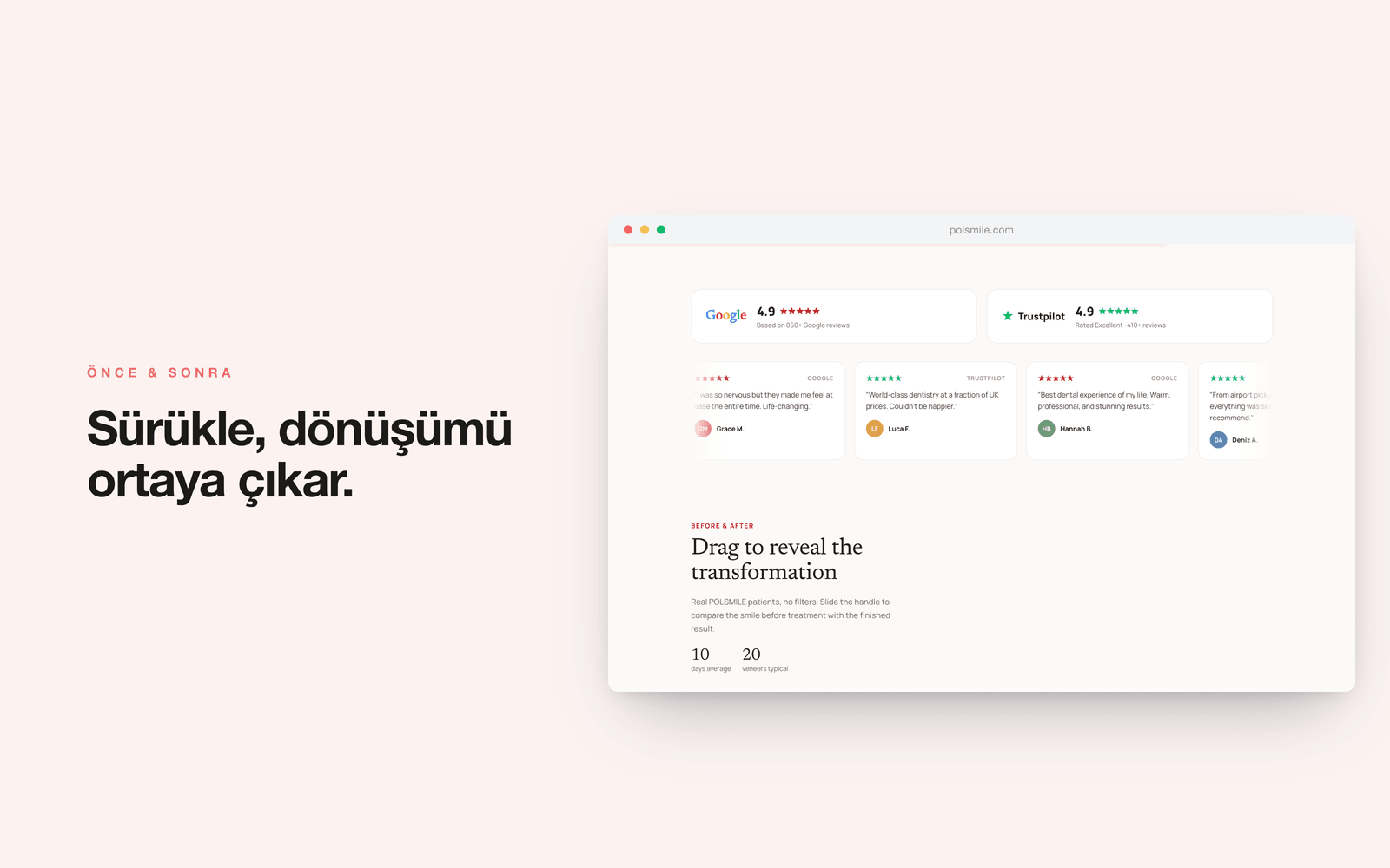 POLSMILE — Google ve Trustpilot puanları, önce/sonra karşılaştırması