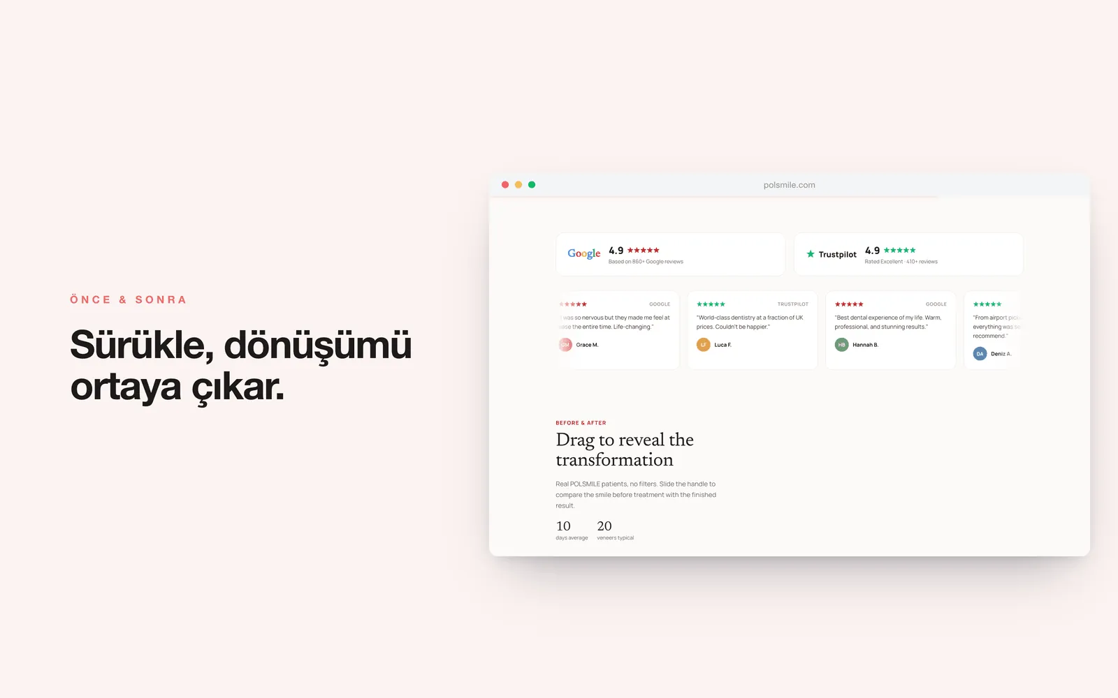 POLSMILE — Google ve Trustpilot puanları, önce/sonra karşılaştırması