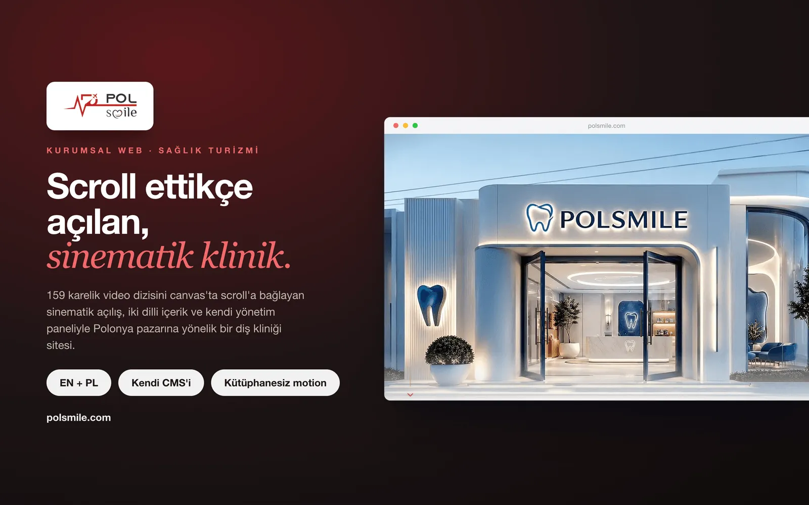POLSMILE — ürün ekran görüntüsü
